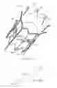 Fig. 16 - Systems, devices and methods for transcatheter valve delivery