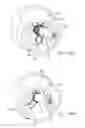 Fig. 20 - Systems, devices and methods for transcatheter valve delivery
