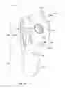 Fig. 16 - Shoulder implant components