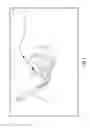 Fig. 02 - System and method for performing percutaneous spinal interbody fusion