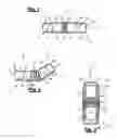 Fig. 02 - Spinal surgical implant and related methods