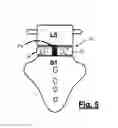 Fig. 04 - Spinal surgical implant and related methods
