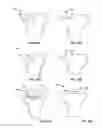 Fig. 10 - Bone pads