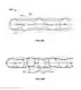 Fig. 18 - Bone pads