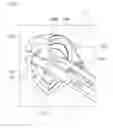 Fig. 07 - Acetabular cup detaching apparatus for artificial hip joint