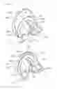 Fig. 18 - Acetabular cup detaching apparatus for artificial hip joint