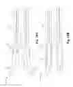 Fig. 13 - Bone fusion surgical system and method