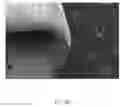 Fig. 08 - Scaffold system for tissue repair