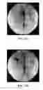 Fig. 21 - Scaffold system for tissue repair