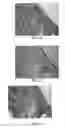 Fig. 25 - Scaffold system for tissue repair