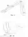Fig. 19 - Endovascular implant