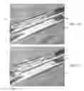 Fig. 25 - Endovascular implant