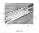 Fig. 26 - Endovascular implant
