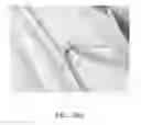 Fig. 28 - Endovascular implant