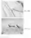 Fig. 29 - Endovascular implant