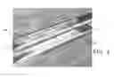 Fig. 04 - Endovascular implant