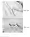 Fig. 29 - Endovascular implant