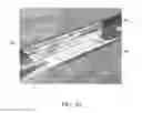 Fig. 24 - Endovascular implant
