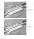 Fig. 25 - Endovascular implant