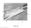 Fig. 26 - Endovascular implant