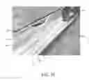 Fig. 27 - Endovascular implant