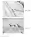 Fig. 29 - Endovascular implant
