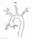 Fig. 02 - BRANCH STENT RETENTION CUFF
