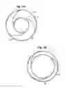 Fig. 11 - BRANCH STENT RETENTION CUFF
