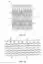 Fig. 07 - Uncaging stent