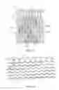 Fig. 08 - Uncaging stent