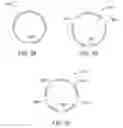 Fig. 104 - Uncaging stent