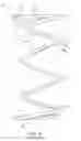 Fig. 11 - Uncaging stent