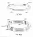 Fig. 126 - Uncaging stent