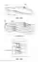 Fig. 127 - Uncaging stent