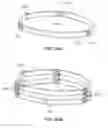 Fig. 128 - Uncaging stent
