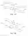 Fig. 14 - Uncaging stent