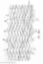 Fig. 23 - Uncaging stent