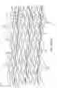 Fig. 24 - Uncaging stent