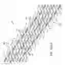 Fig. 25 - Uncaging stent