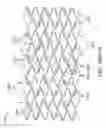 Fig. 26 - Uncaging stent