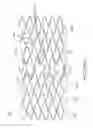 Fig. 56 - Uncaging stent