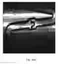 Fig. 60 - Uncaging stent