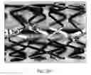 Fig. 65 - Uncaging stent
