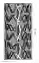 Fig. 70 - Uncaging stent