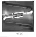 Fig. 71 - Uncaging stent
