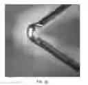Fig. 72 - Uncaging stent