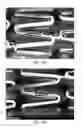 Fig. 75 - Uncaging stent