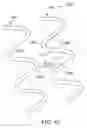 Fig. 85 - Uncaging stent