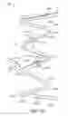 Fig. 93 - Uncaging stent