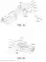 Fig. 97 - Uncaging stent